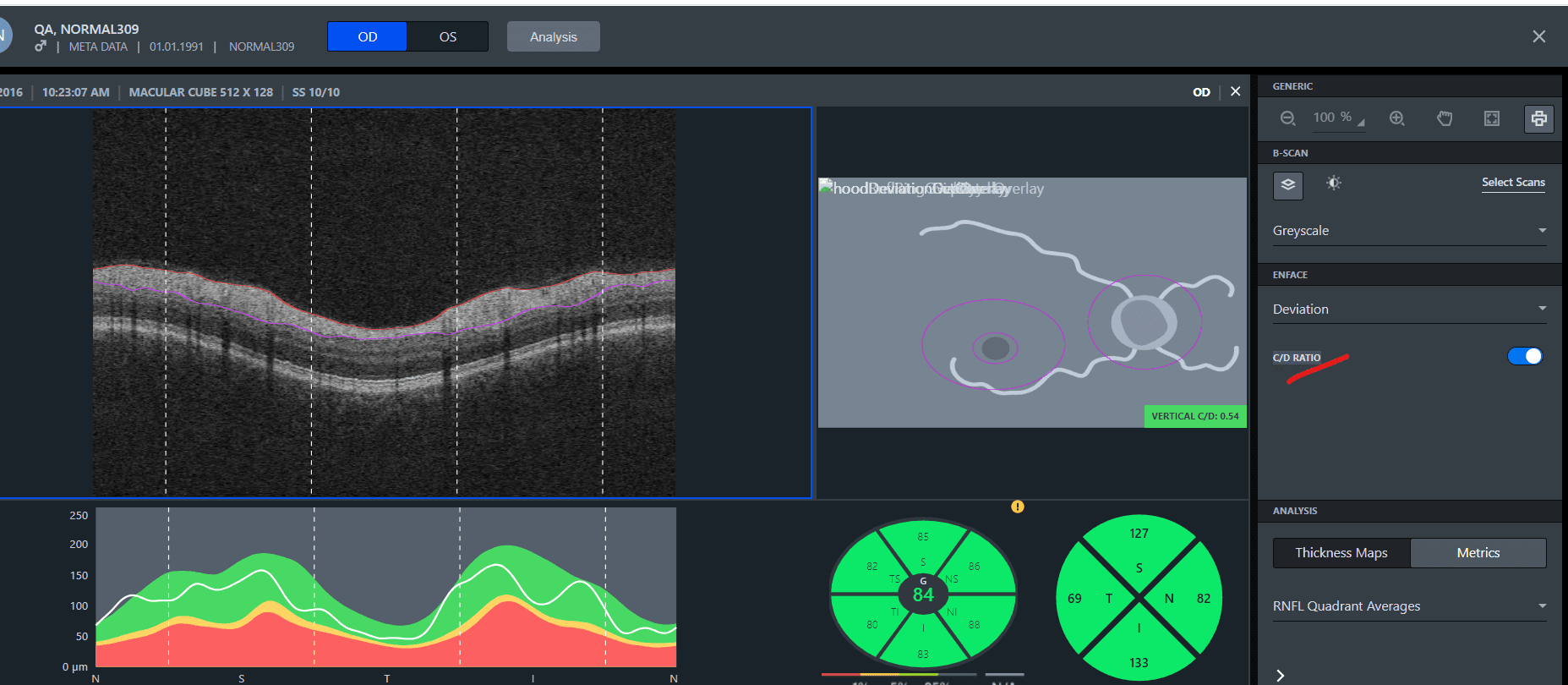Zeiss Health Data Platform